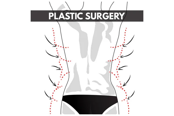 Chirurgia plastica. Illustrazione vettoriale . — Vettoriale Stock