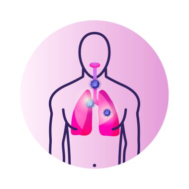 Coronavirus insana akciğer ve covid19 molekülü olan vecto bulaştırdı.