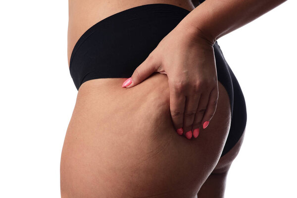 Oversize female pinching skin on her butt for test