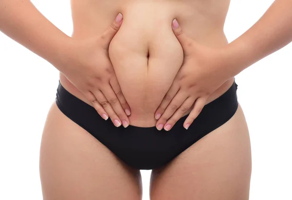 Mujer Obesa Aprieta Grasa Estómago — Foto de Stock
