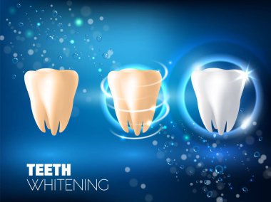 Reklam diş beyazlatma gerçekçi illüstrasyon vektör