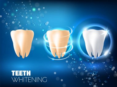 Teeth whitening ad vector realistic illustration clipart