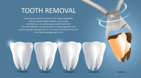 Modelo de banner de cartaz médico vetor de remoção de dentes —  Vetores de Stock