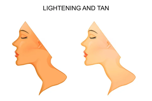 Bronzeamento e clareamento da pele . —  Vetores de Stock