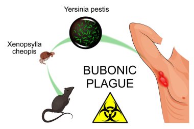 bubonic plague, contagious  clipart