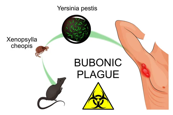 Peste bubónica, contagiosa — Vector de stock