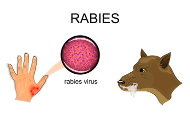 dog bite, sick animal, the rabies virus clipart