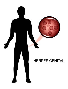 virüs genital herpes insanlarda