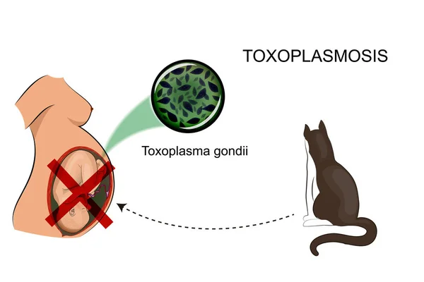 Toxoplasmos infektion hos gravida kvinnor — Stock vektor