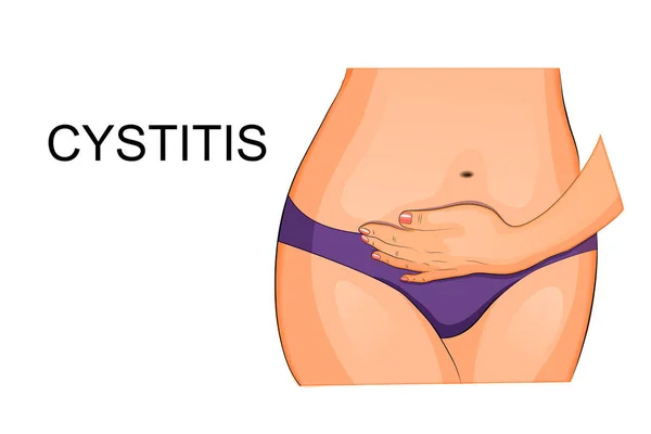 Inflammation of the pelvic organs — Stock Illustration Inflammation of the pelvic organs Stock Illustration