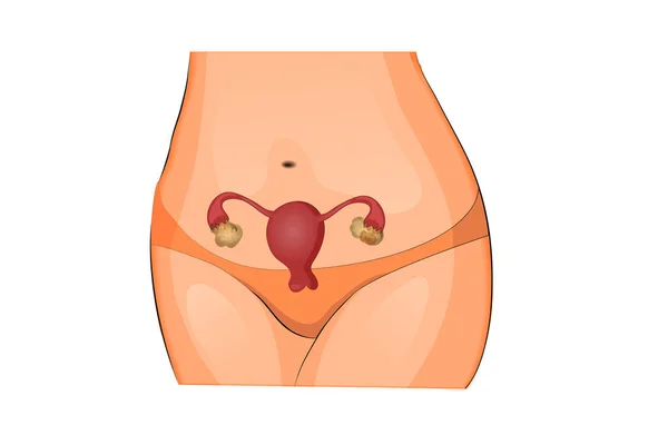 Женская репродуктивная система — стоковый вектор