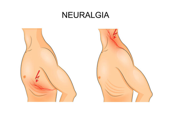 male torso with chest pain