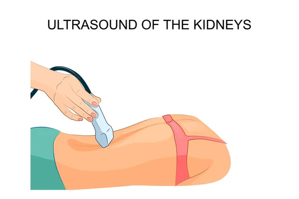 Ultrasound of the kidneys — Stock Vector