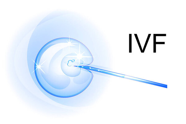 illustration of artificial insemination