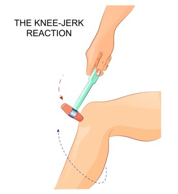 the knee-jerk reflex clipart