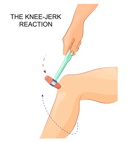 Odruchowym reflex — Wektor stockowy