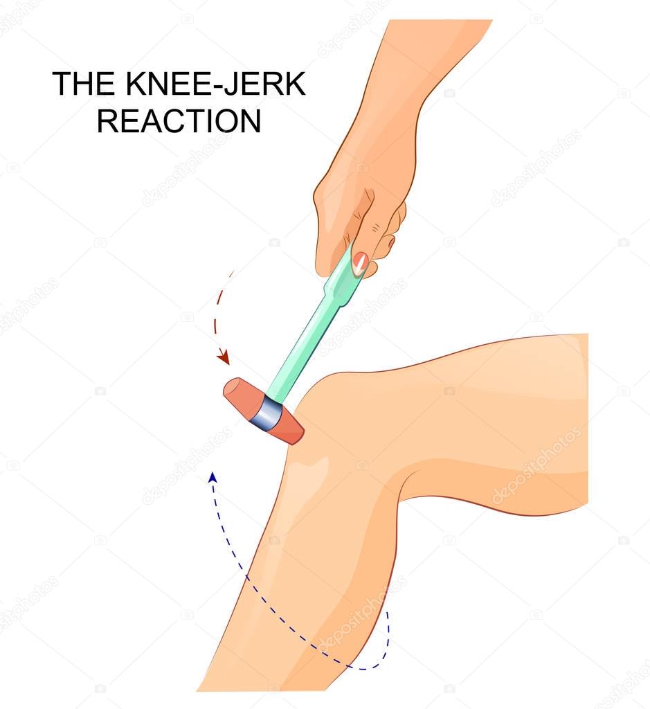 the knee-jerk reflex