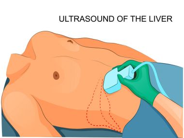 Ultrasound of the liver clipart