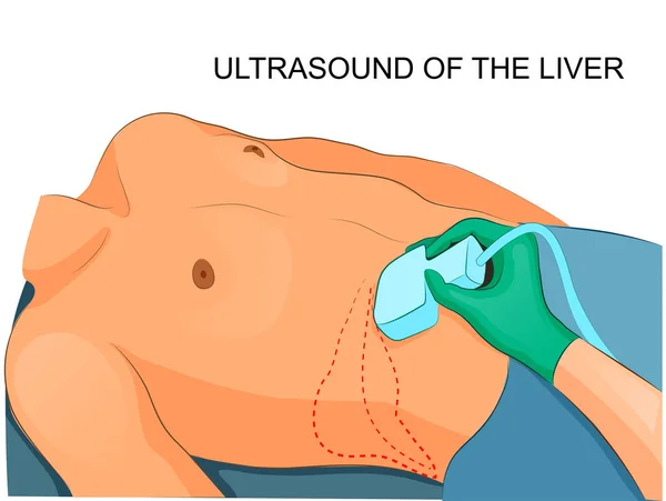 Ultraschall der Leber — Stockvektor