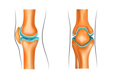 a healthy knee clipart
