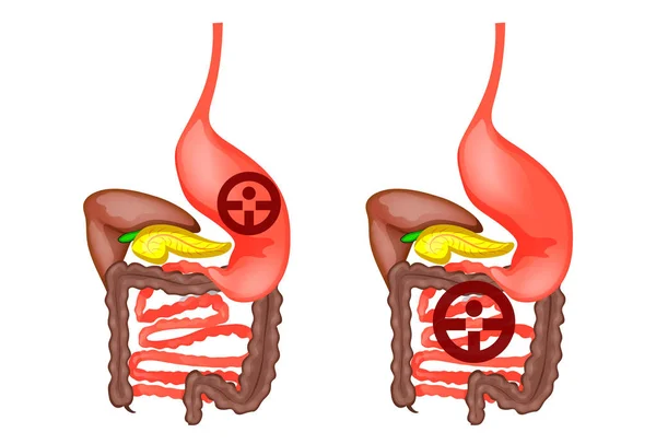 Il tratto digestivo umano — Vettoriale Stock