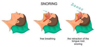 Uyuyan adam snores