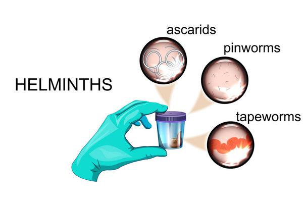 the analysis of a feces on eggs of worms