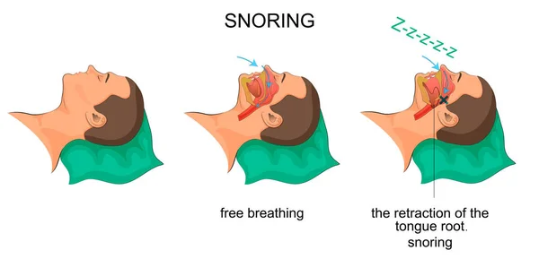 Hombre dormido ronca — Vector de stock