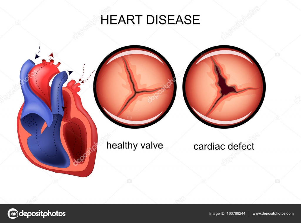 TÉLÉCHARGER CARDIAK CARDIOLOGIE CARDIAK CARDIOLOGIE TÉLÉCHARGER