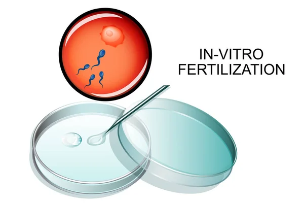 Fécondation in vitro . — Image vectorielle