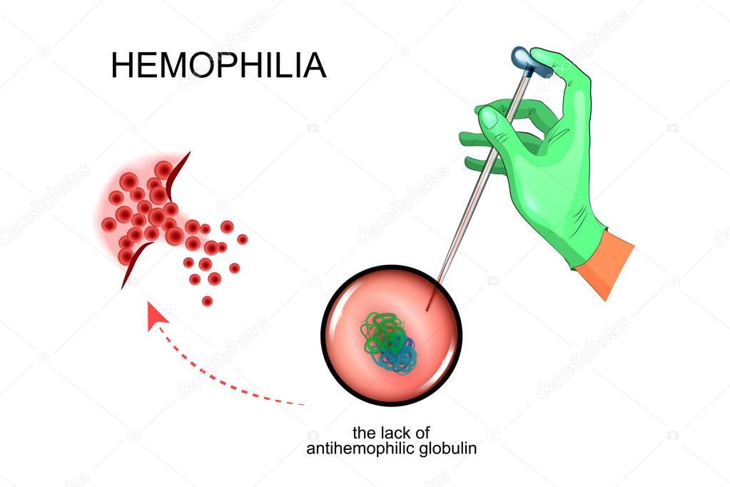the pathological process in hemophilia