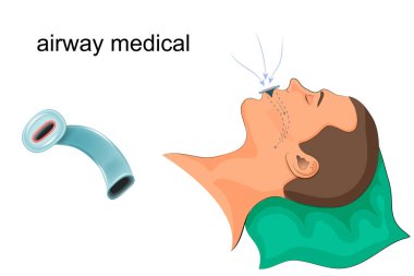 medical the duct in the mouth clipart