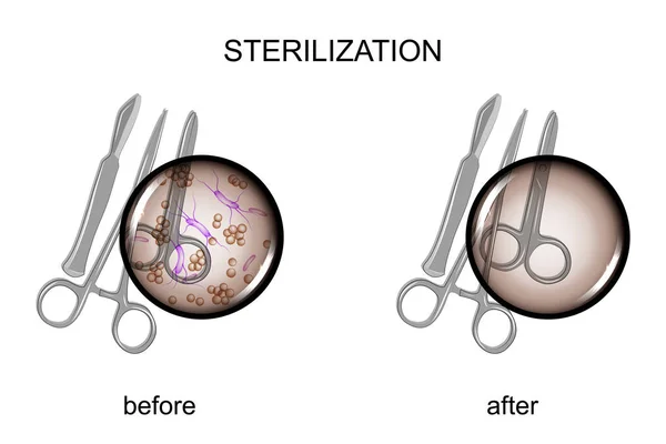 Instrumentos quirúrgicos antes y después de la esterilización — Vector de stock