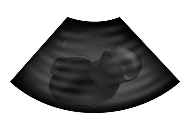 Ultra-som do feto. ginecologia e obstetrícia — Vetor de Stock