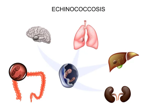 O agente causador Echinococcus —  Vetores de Stock