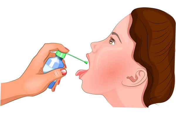 Trattamento delle tonsille con un antisettico — Vettoriale Stock
