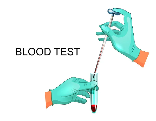 Analisi di laboratorio del sangue — Vettoriale Stock