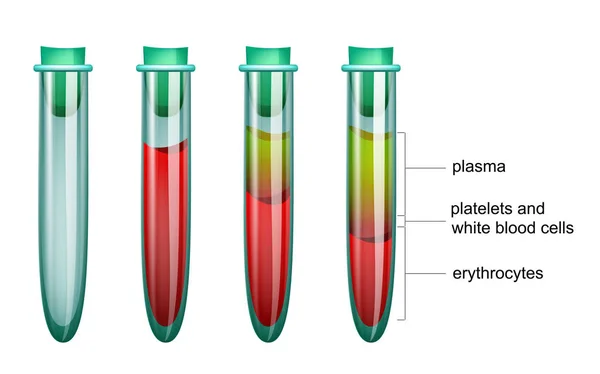 Sangre en el tubo de ensayo, el plasma y los eritrocitos — Vector de stock