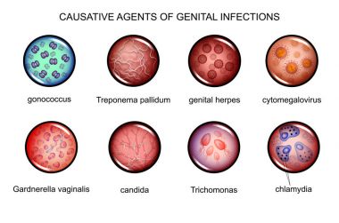 the causative agents of sexually transmitted infections clipart