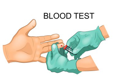 parmak analiz için kan alma