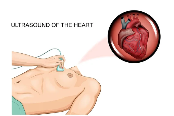 Ultrason kalp — Stok Vektör