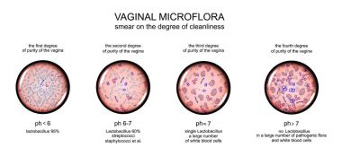 vaginal microflora. degree of purity of the vagina clipart