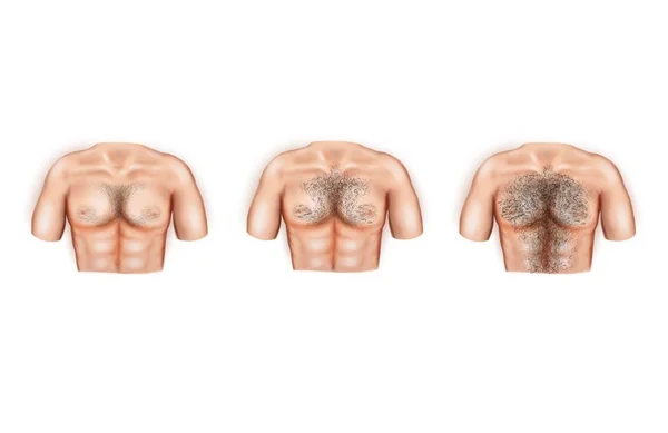 Illustration Typer Manliga Bröst Hår — Stockfoto