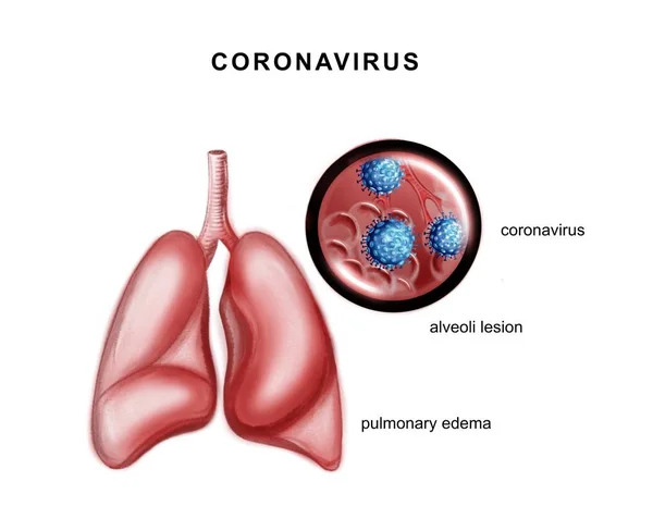 Illustration Patogenen Hos Coronavirus — Stockfoto