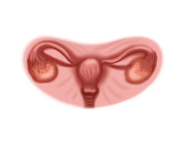 健康な子宮のイラスト チューブと卵巣 — ストック写真