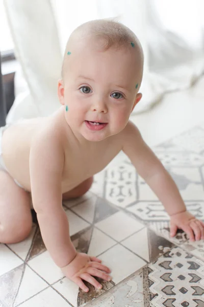 Bebé con varicela en el suelo — Foto de Stock