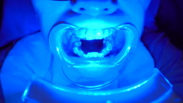 Крупный план специального оборудования для отбеливания зубов — стоковое видео