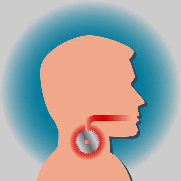 Боль в горле похожа на пилу. — стоковый вектор