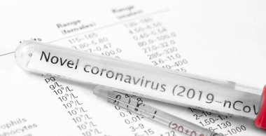 Roman Coronavirus (2019-nCoV). Metin Roman Coronavirus (2019-nCoV) ile test tüpü, genel kan analizinde cam tüp yakın plan sonuçları