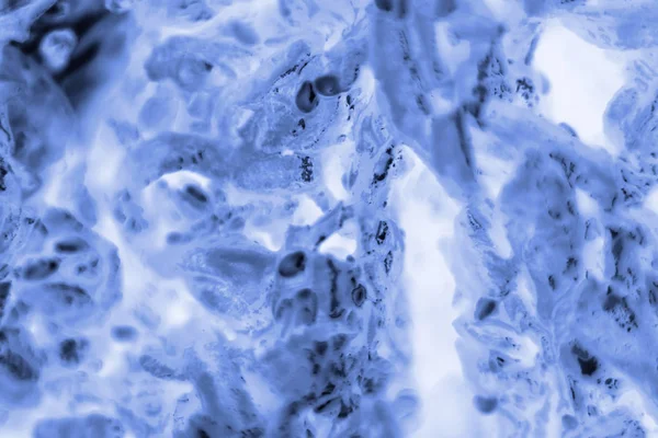 Pc-3 lidské buňky rakoviny prostaty obarvené modrou Coomassie, un — Stock fotografie